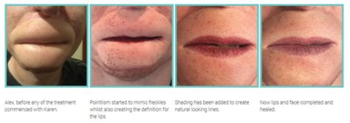 Unveiling The Secrets Of Alex Lewis Lips: Discoveries And Insights