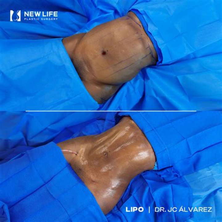 Unlocking The Secrets Of New Life Plastic Surgery: A Journey Of Transformation