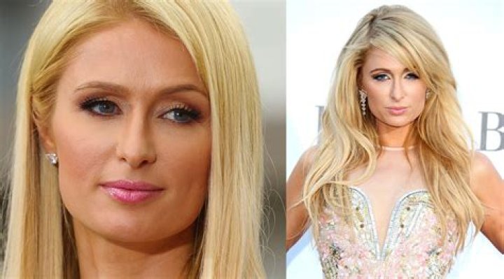 Unveiling The Truths Behind Paris Hilton's Nose Job Transformation